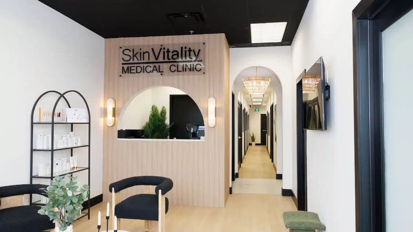 Teoysal Filler for Tear Troughs