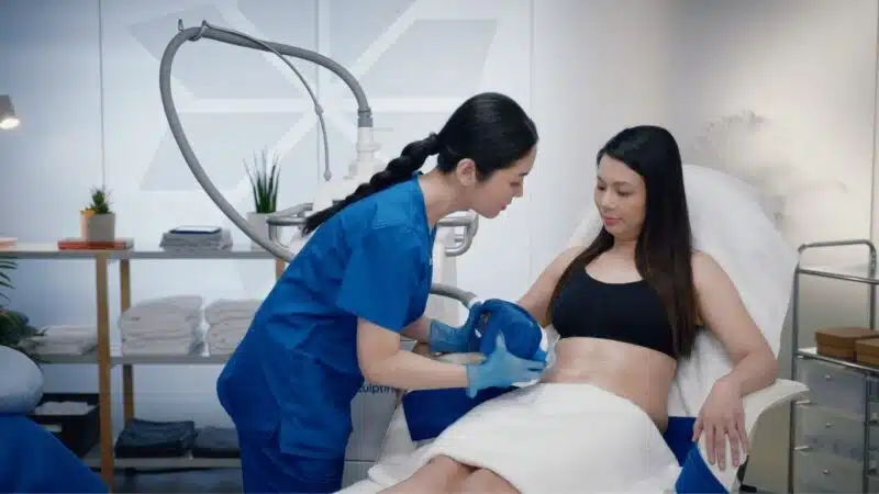 CoolSculpting Treatment