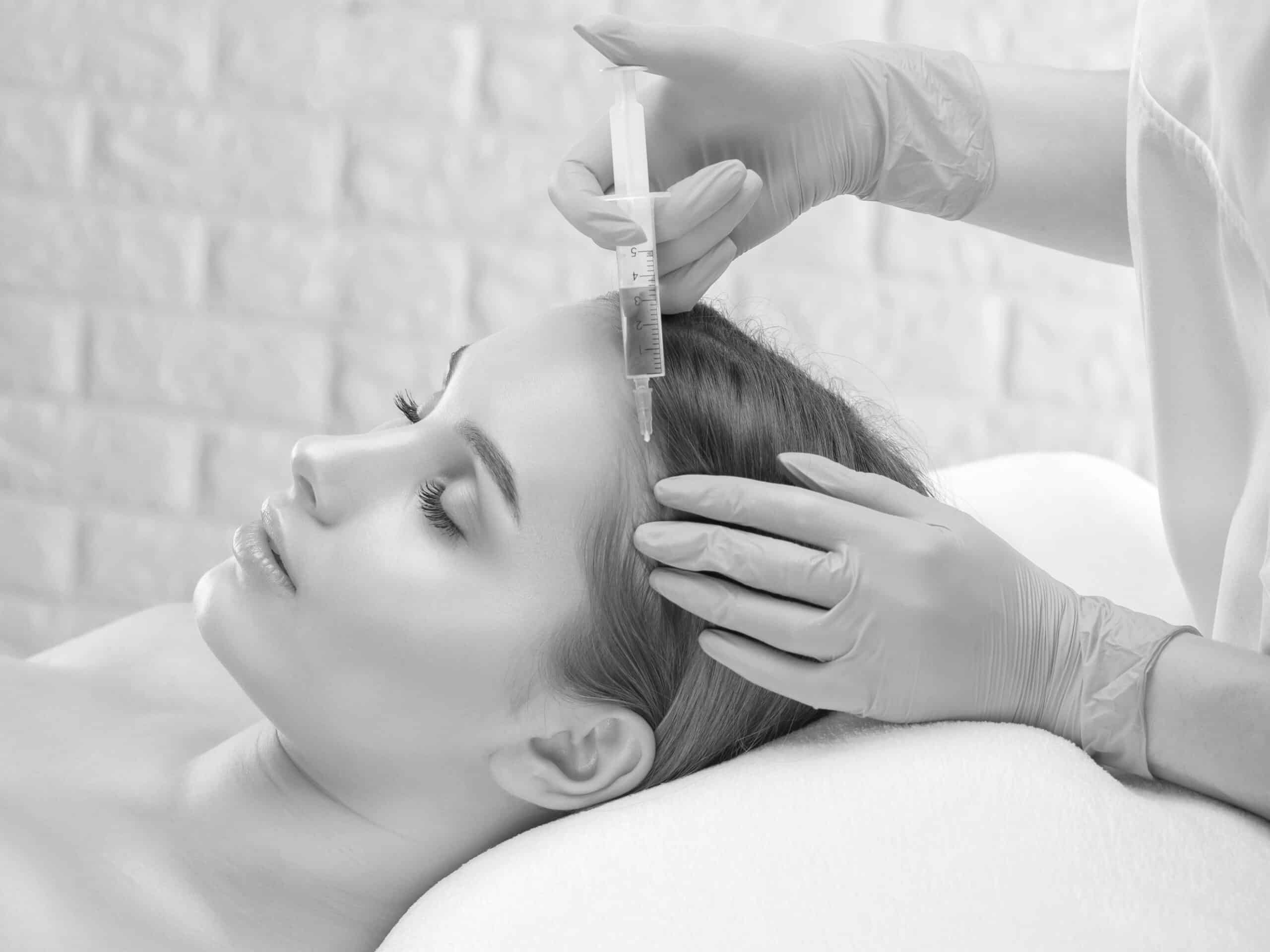PRP Hair Treatment Toronto | PRP Hair Restoration Ontario PRP Hair Treatment Toronto | PRP Hair Restoration Ontario