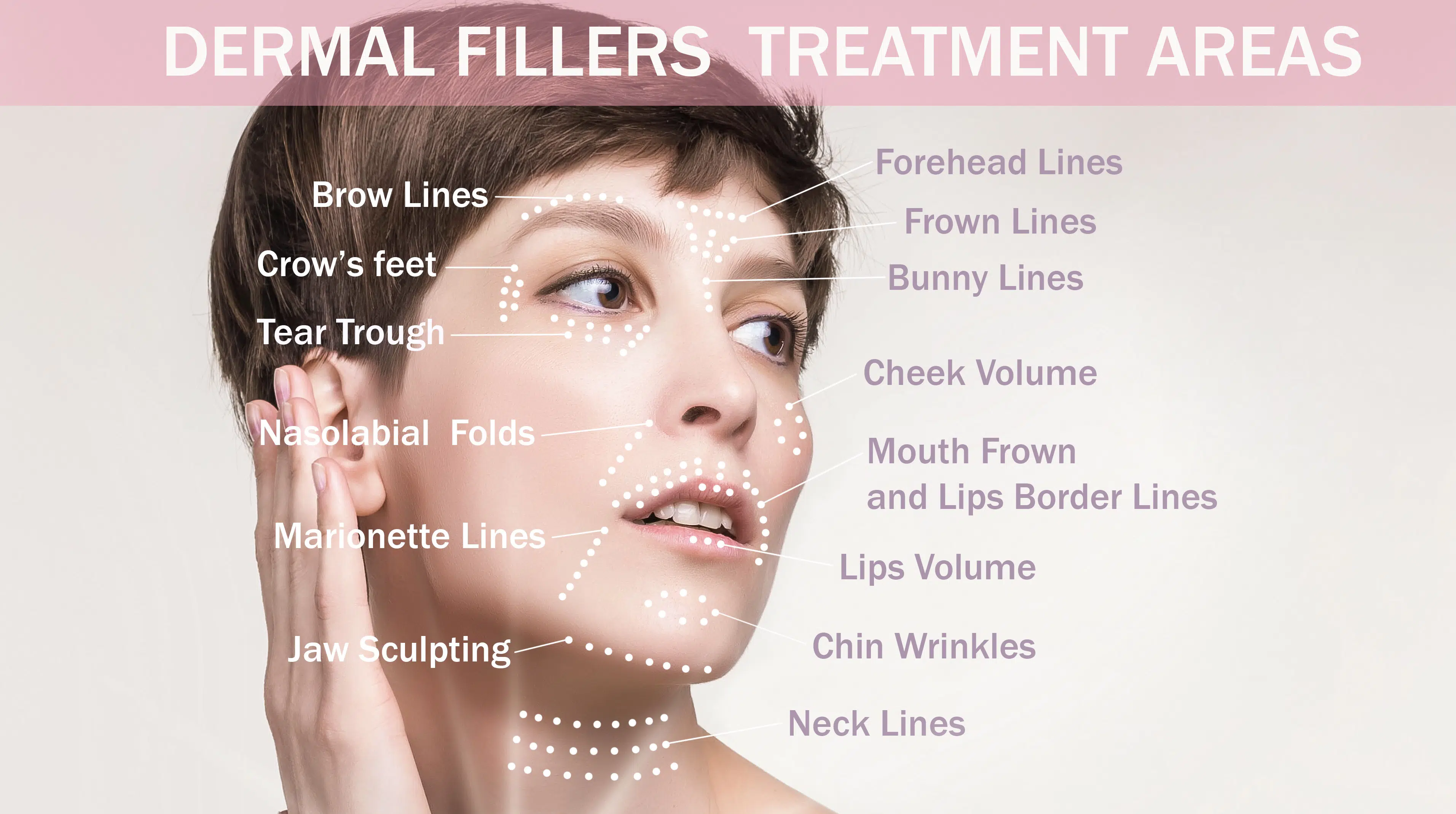 Dermal Filler Treatment Areas