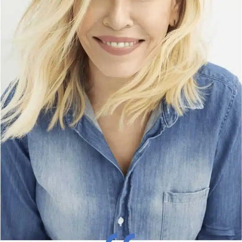 Chelsea Handler Fraxel