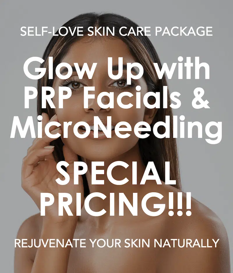 MicrNeedling Sale February