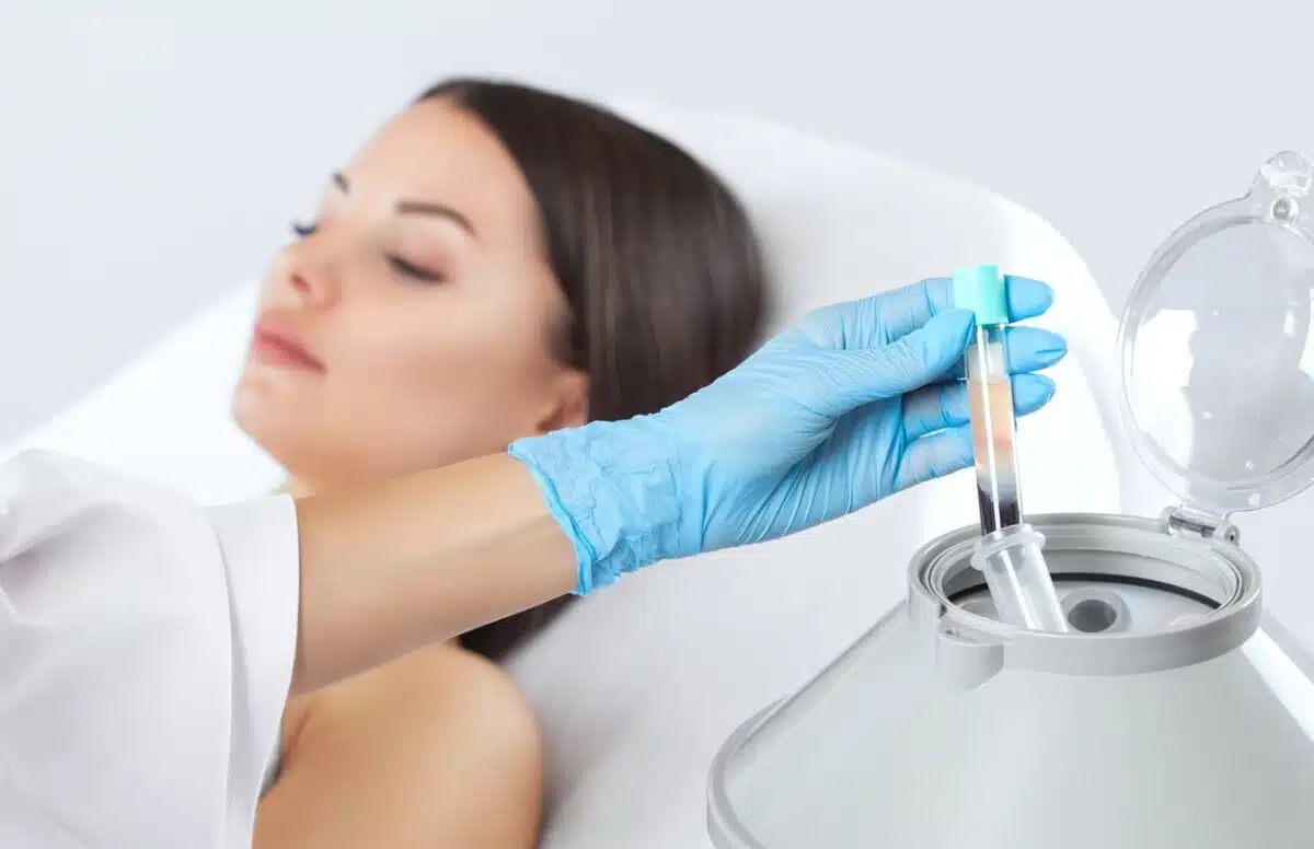 PRP Vampire Facial