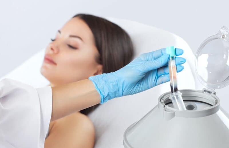 PRP Vampire Facial