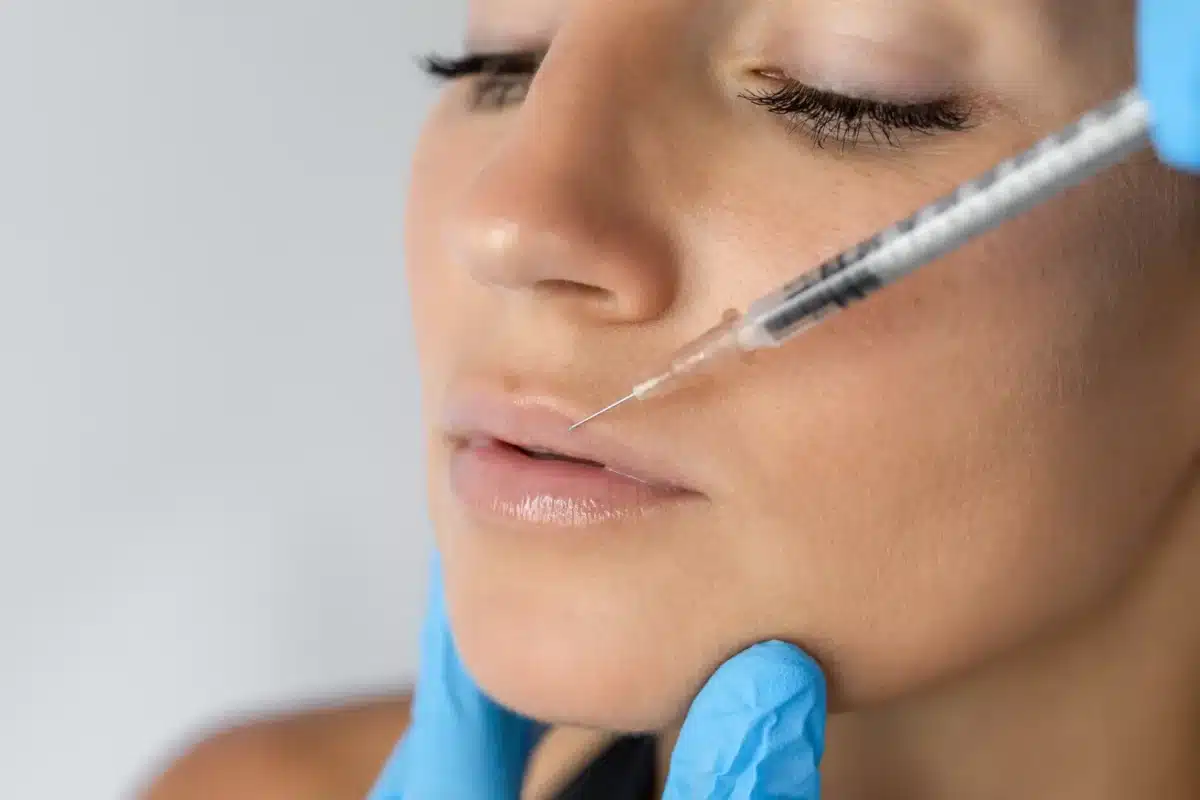 How long does a lip flip last?