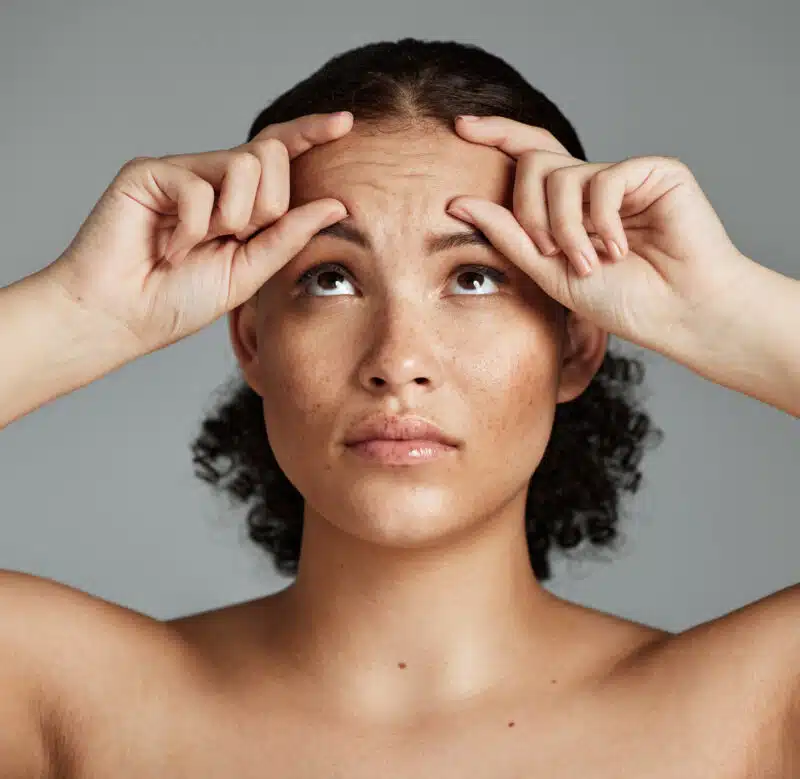 How Long Forehead Botox Lasts