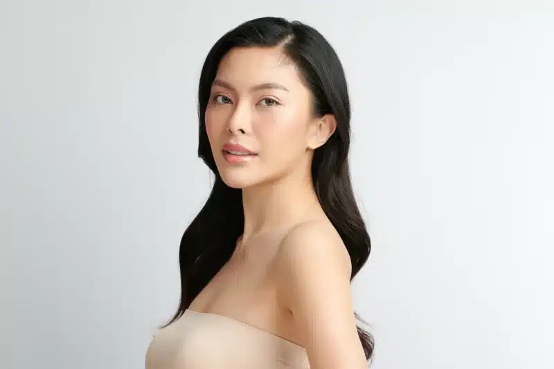 Natural-looking Juvéderm results